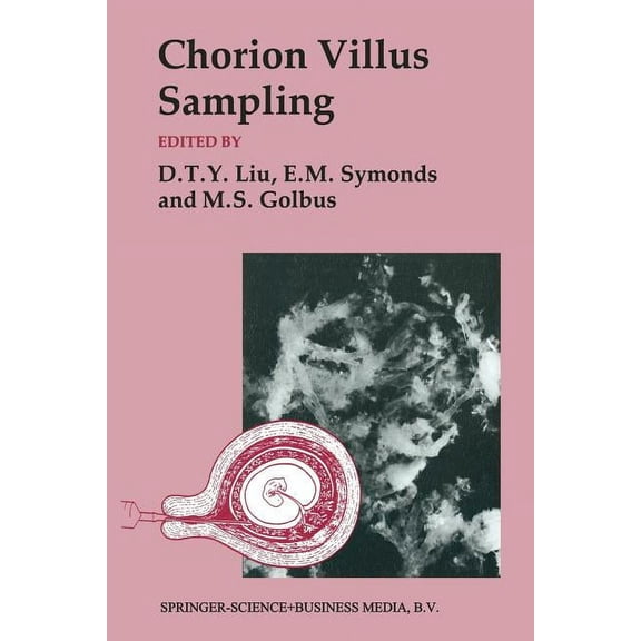 Chorion Villus Sampling, (Paperback)