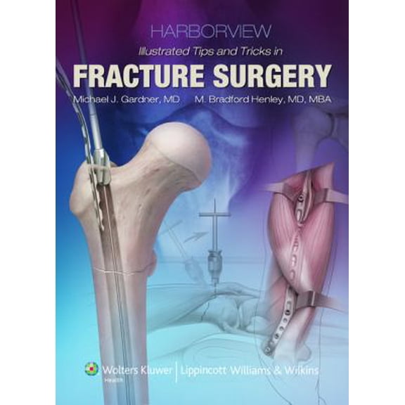 Pre-Owned Harborview Illustrated Tips and Tricks in Fracture Surgery (Hardcover) 1605470554 9781605470559