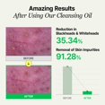 thumbnail image 4 of Aceite Limpiador VEGANIFECT Green Barley Light 205 ml Sensitive, 4 of 8