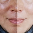 thumbnail image 5 of Crema Facial Ootness Kit SkinCare Ácido Tranexámico y Thanaka, 5 of 5