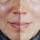 thumbnail image 5 of Crema Facial Ootness Kit SkinCare Ácido Tranexámico y Thanaka, 5 of 5
