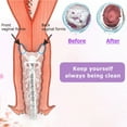 thumbnail image 6 of Vaginal Douche Enema Cleaner 300ml Reusable Manual Pressure Anal Vaginal Cleaning System Portable Kit with 3 Nozzles, 6 of 8