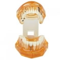thumbnail image 3 of Implant Model, Pathological Anatomy Tooth Education, Reconstruction On Implant For  Schools Discussion Of Treatment, 3 of 8