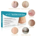 thumbnail image 5 of Aliver 4 Reusable Scar Removal Sheet, Silicone Professional Scar Tape 5.9"×1.6", 5 of 8