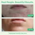 thumbnail image 4 of Exfoliante casero con ácido glicólico Peel YEOUTH, 30% AHA, 30 ml con retinol, 4 of 8