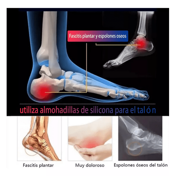 Espolón Calcáneo Masajes Para Aliviar La Fascitis Plantar Masaje