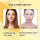 thumbnail image 3 of OUHOE Turmeric Facial Repair Essence, skin repair, anti-wrinkle, lightening of fine lines and dark spots, hydrating and mo, 3 of 4