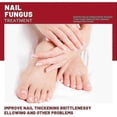thumbnail image 3 of EELHOE 3 Boxes 50ml Nail Repair Solution Cuticle Revitalizing Nail Hydrating Care Liquid CNO.16663, 3 of 5