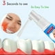 thumbnail image 3 of Spray dental instantáneo para aliviar el dolor dental Afortunado Sencillez, 3 of 5