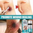 thumbnail image 3 of Medical Glue For Cuts, Fast-drying & Breathable Liquid Skin Bandage, Great For Use On Fingers, 3 of 5