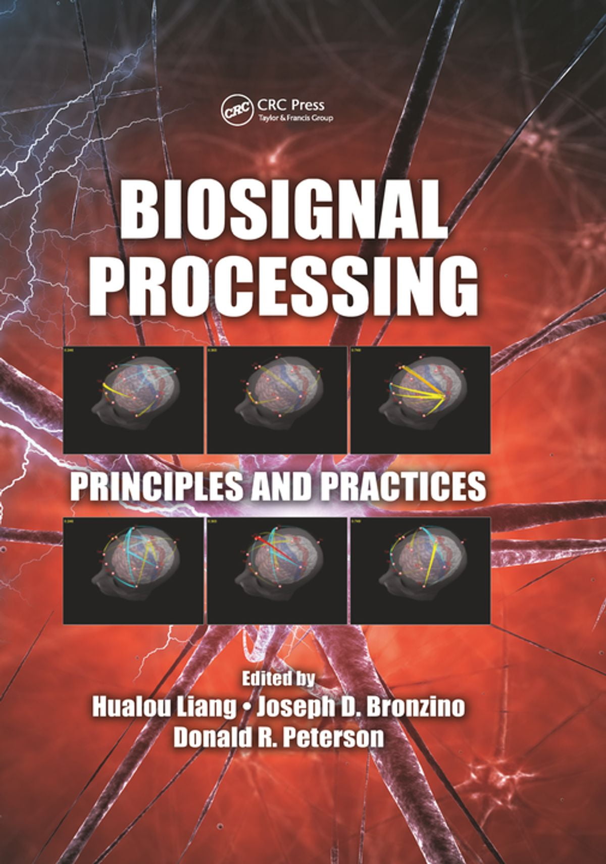 Biosignal Processing eBook
