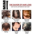 thumbnail image 4 of Jaysuing Anti Hair Loss Ball Anti Hair Loss Products Hair Growth Hair Growth For Men Hair Growth Oil For Black Women Xinda, 4 of 4