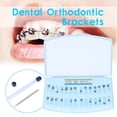 thumbnail image 3 of Brackets Autoligables, Brackets de Ortodoncia Dental Autoligables, Brackets de Ortodoncia Dental Activos, Brackets de Ortodoncia de Diseño de Clase Mundial, 3 of 9