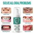 thumbnail image 5 of 1-3pcs Mint Teeth Mouthwash, Herbal Brightening Oral Repair Foam, Solve All Problems, 5 of 5