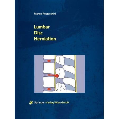 UPC: 9783709173220 | Lumbar Disc Herniation (Paperback)