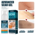thumbnail image 4 of Advanced Scar Gel Scar Repair Cream Face Remove Acne Smoothing Blanqueamiento Tmvgtek cuidado belleza, 4 of 9