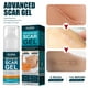 thumbnail image 4 of Advanced Scar Gel Scar Repair Cream Face Remove Acne Smoothing Blanqueamiento Ndcxsfigh Nuevos Originales, 4 of 9