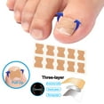 Ingrown Toenail Corrector Stickers Foot Care Stickers Non Glue Toenail
