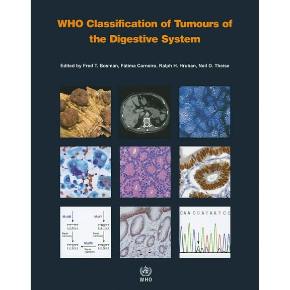 WHO Classification of Tumours of the Digestive System