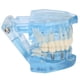 thumbnail image 1 of Modelo De Simulación De Dientes Dentales, Modelo De Dientes Livianos Para Demostración De Investigación De Patología Ccdes Otros, 1 of 8
