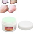 thumbnail image 4 of Crema Reparadora De Picazón En La Piel, Repone El Agua, Reduce El Enrojecimiento, Crema Hidratante Reparadora De La Piel, Exfoliación Para El Hogar ANGGREK Skin Repair Cream, 4 of 8