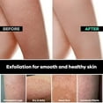 thumbnail image 6 of Dermasuri Exfoliating Glove - Exfoliating Mitt, Body Scrubber Dead Skin Remover for Body (2 Pack), 6 of 9