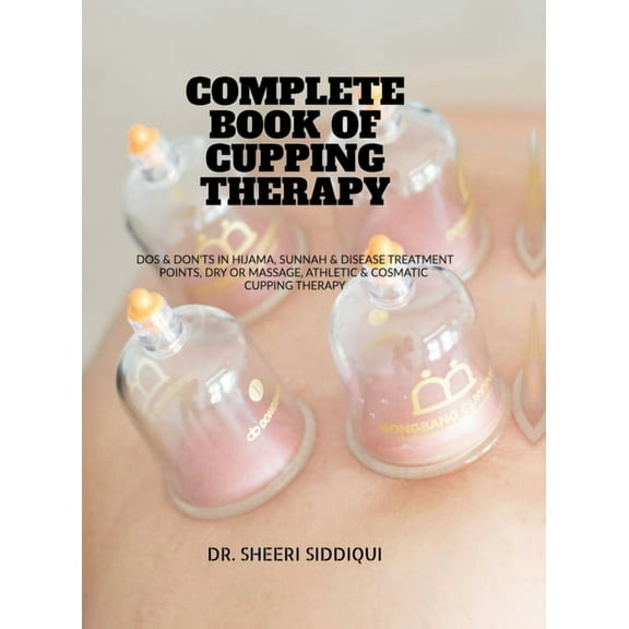Complete Book of Cupping Therapy: DOS & Don'ts in Hijama, Sunnah & Disease Treatment Points, Dry or Massage, Athletic & , (Hardcover)