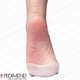 thumbnail image 5 of Ball Of Foot Cushion Metatarsal Foot Pads Mortons Neuroma Pain Relief, 5 of 5