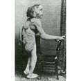 thumbnail image 2 of Joseph Merrick, The Elephant Man Poster Print by Science Source (18 x 24), 2 of 2