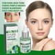 thumbnail image 4 of Suero Eliminador de manchas oscuras ANGGREK 2 unidades 30 ml, 4 of 7
