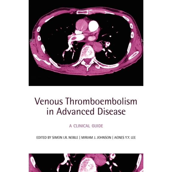 Venous Thromboembolism in Advanced Disease: A Clinical Guide, (Paperback)