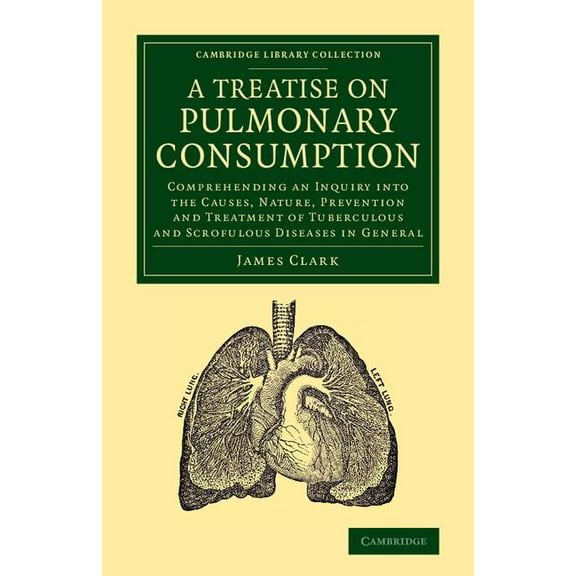 Cambridge Library Collection - History o A Treatise on Pulmonary Consumption: Comprehending an Inquiry Into the Causes, Nature, Prevention and Treatment of Tuber, (Paperback)