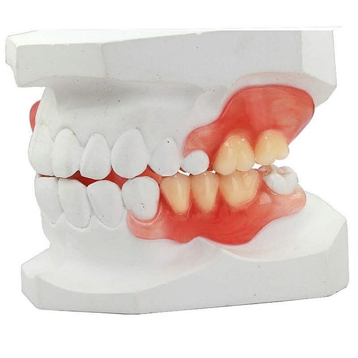 DIY Impression Flexible Partial Denture Flipper