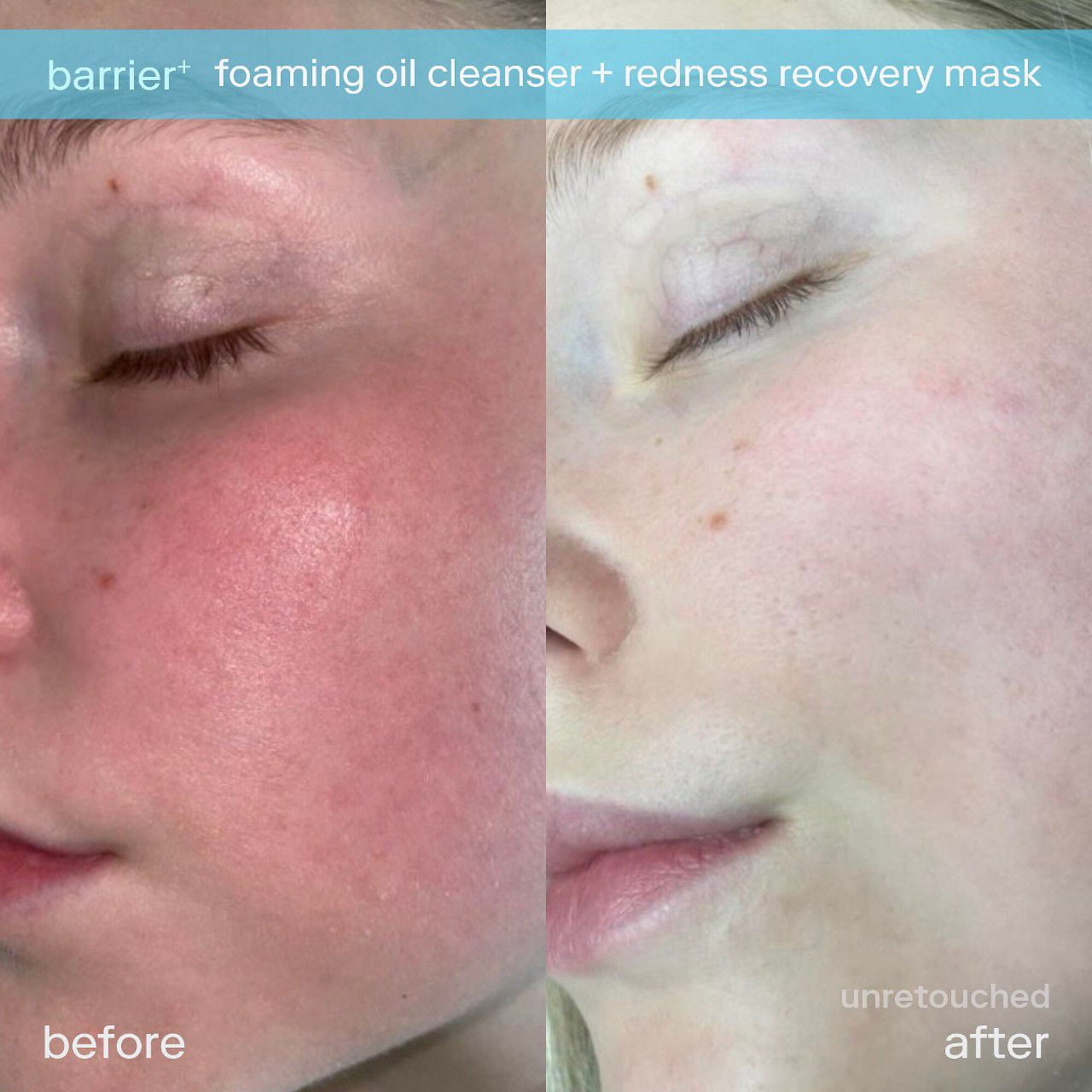 Skinfix Barrier+ Foaming Oil Hydrating Cleanser Color: None Size: N/A