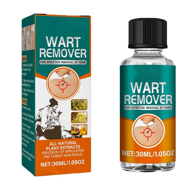 30ml SimpClear All Natural atHome Warts Remover, Plantar Wart
