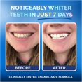 thumbnail image 3 of Teeth Whitening Strips for Sensitive Gums - Peroxide Free and Enamel Safe with Coconut Oil for Whiter Teeth - 7-Day Treatment White Strips with Non-Slip and Dry-Strip Technology, 3 of 10