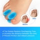 thumbnail image 5 of Qarigey 8 pares de herramientas de corrección de dedos azules que restauran la alineación natural con facilidad Corrector de Hallux Valgus Cuidado de los pies, 5 of 6