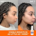 thumbnail image 3 of Sérum corrector de tono Palmer's Skin Success 30 ml, 3 of 7