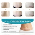 thumbnail image 2 of Aliver 4 Reusable Scar Removal Sheet, Silicone Professional Scar Tape 5.9"×1.6", 2 of 8