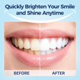 thumbnail image 4 of Tiras blanqueadoras de dientes Selthoo, seguras para esmalte sensible, 4 of 7