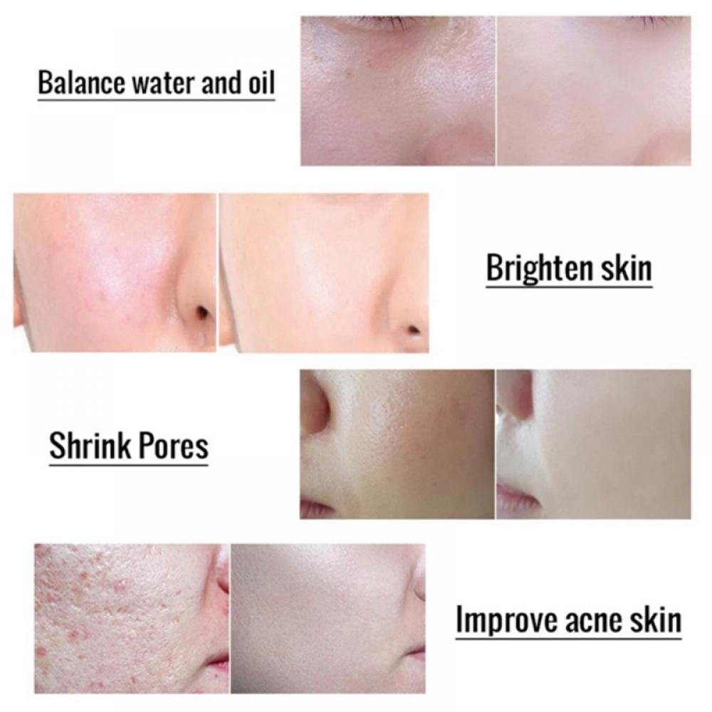 Buy Saient Glycolic Acid Peel 70 Pro Skin Peel Age Defying, Erase