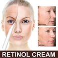thumbnail image 5 of 1-3pcs Retinol Wrinkle Remover Instant Anti-Aging Retinol Face Cream Skin Tightening Firming Moisturizing Whitening, 5 of 5