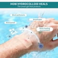 thumbnail image 2 of QARUN Hydrocolloid Roll for Wound Care,Pimple Patch Roll Tape Medical Grade Bandages for Acne,Blisters,Burn Self-Adhesive Ultra Absorbent Flexible Waterproof 2In Width Diy Size(2In*16Ft), 2 of 7
