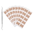 thumbnail image 3 of Parche corrector para uñas encarnadas, 9 piezas/juego, herramienta para alisar uñas encarnadas, adhesivo corrector para uñas encarnadas, durabilidad probada en el tiempo, 3 of 14