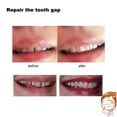 thumbnail image 5 of Pegamento Dental de 10/100g pegamento temporal sólido para dentadura pegamento para huecos de dientes pegamento para blanqueamiento Dental, 5 of 5
