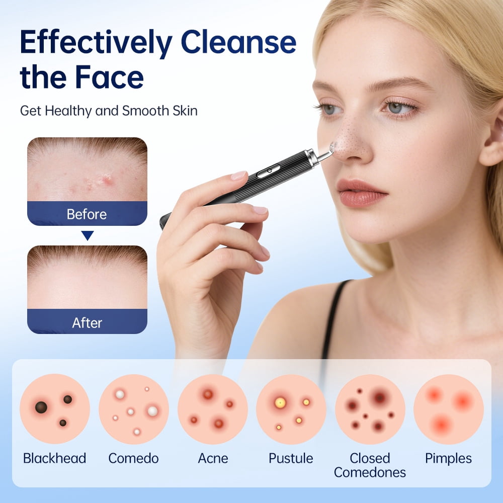 Visual Pore Cleaner, Deep Cleaning Comedone Tool, 50Times Magnification 1296P, WiFi Visual Blackhead Remover Tools with Lights, Women Gift