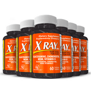 X Ray Triple Action Joint Health Supplement, Glucosamine Chondroitin, MSM, Vitamin D, 60 CT (Pack of 6)
