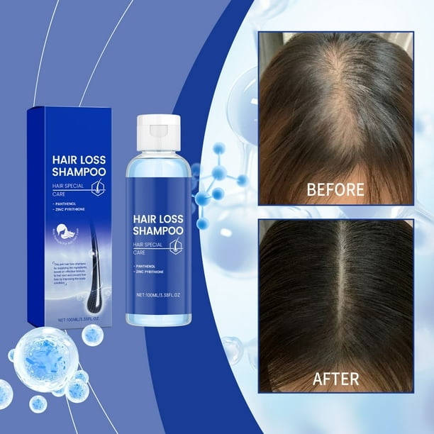 Fiudx Champú de Nutrición Profunda, Fórmula Hidratante y Reparadora, Mejora La Elasticidad Del Cabello, Ingredientes Suaves, Reduce La Rotura, Apto para Todo Tipo de Cabello, Cuidado Refrescante Del