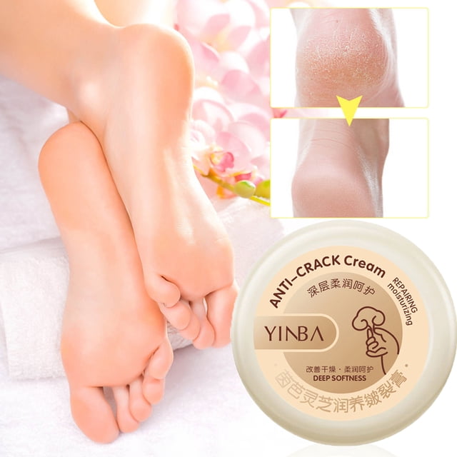 Fiudx Crema para Grietas, Crema Hidratante Reparadora Intensiva, Crema Nutritiva para Pies, Manos y Codos, Crema Exfoliante para Aliviar La Piel Seca, Tratamiento para Piel Seca y Agrietada, Esencial