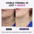 thumbnail image 2 of Crema reafirmante para cuello y escote GOOSURE con retinol 125 ml, 2 of 7